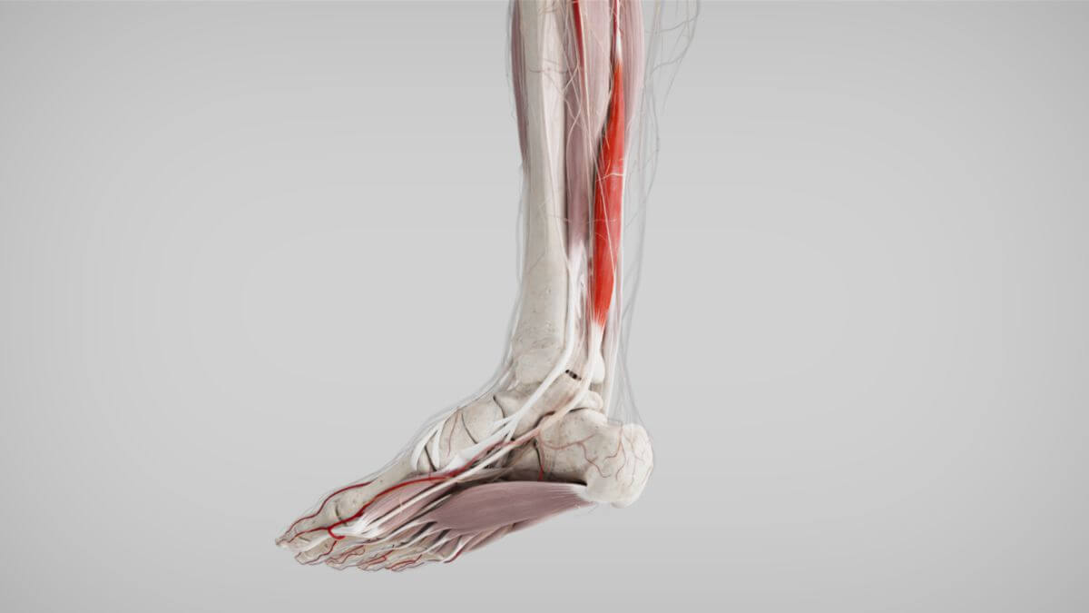 Flexor Hallucis Longus (FHL) Tendon Rupture